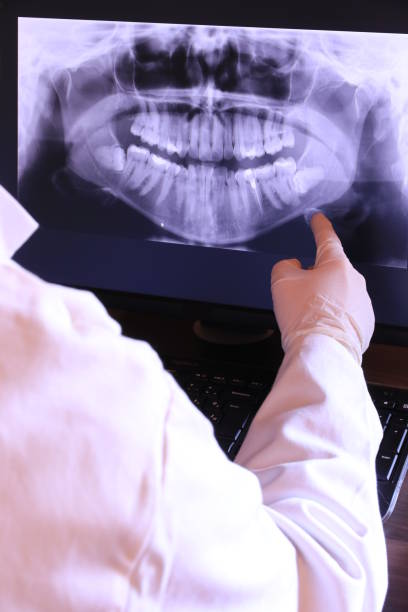 Best Emergency Dental Care for Broken or Chipped Teeth in Holbrook, NY