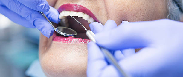 Best Urgent Care for Lost Fillings or Crowns in Holbrook, NY
